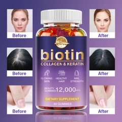 WEEM Hair Skin & Nails Gummies – Biotin Vitamins for Healthy Hair, Skin & Nails