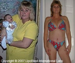 #1 Best Diet Pills That Work Fast Extreme Quick Weight Loss Lose Fat Burners