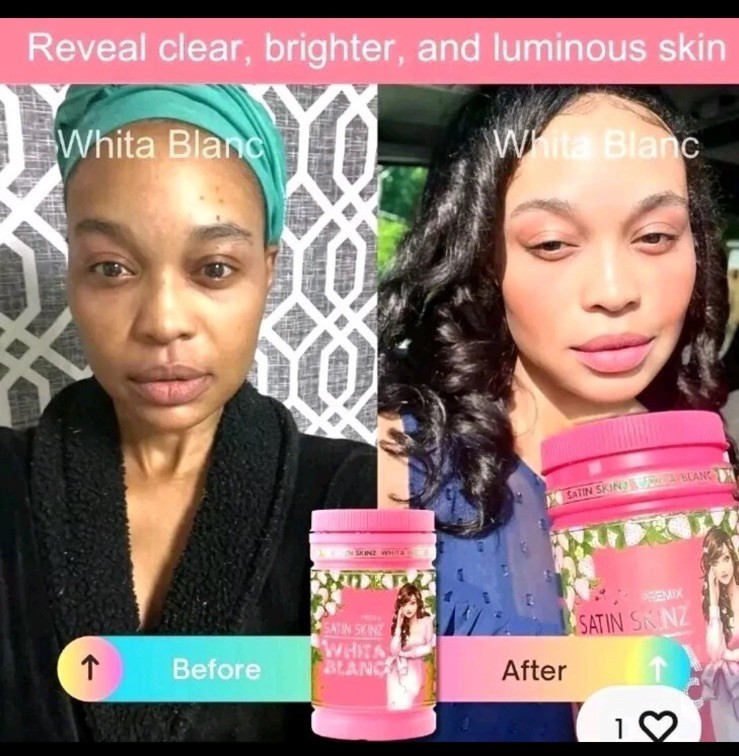 Whita Blanca 800g x 1 jar. 5x more brightening 💯 AUTHENTIC. Satin Skinz