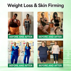Moringa Moringa Berberine NAD+ Weight Loss Patches Advanced Nano Microneedle
