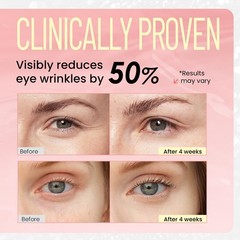 Retinol Eye Cream for Dark Circles: Revive 0.7 Fl Oz (Pack of 1), Pink